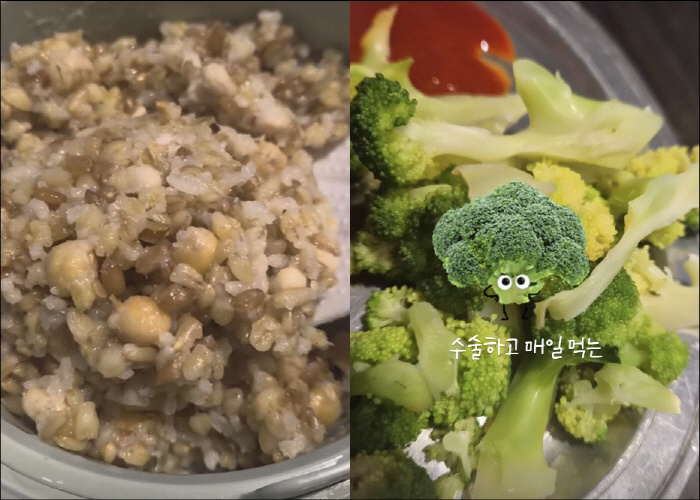 Park Ji-yeon takes care of health food after kidney re-transplantation ♥ Lee Soo-geun washes the dishes every day