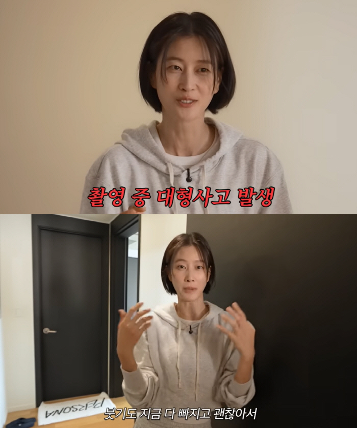 Lee Hyun-yi fractured her nose while filming 'The Girl With the Bone' 'I've been chipping for a month..'Your old face is back'
