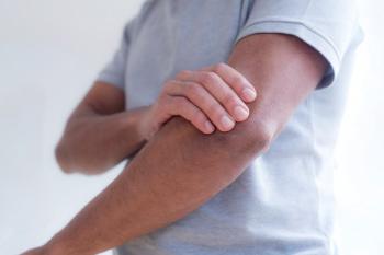 Tennis elbow that occurs without tennis, mistaken for simple muscle pain
