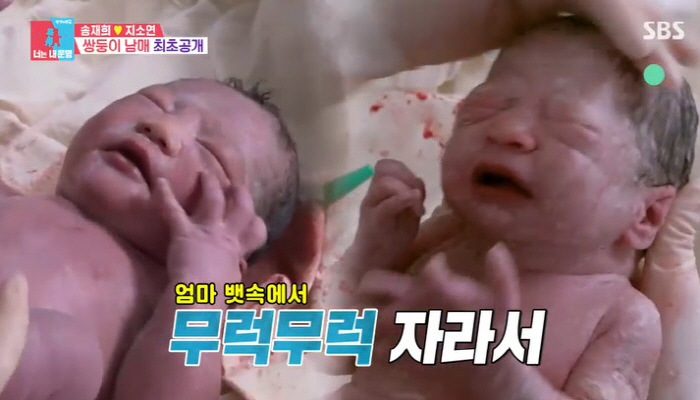 Song Jae-hee ♥ Ji So-yeon, 1 percent chance to give birth to twins for the first time in such a chubby newborn (Dongsang Imong 2)