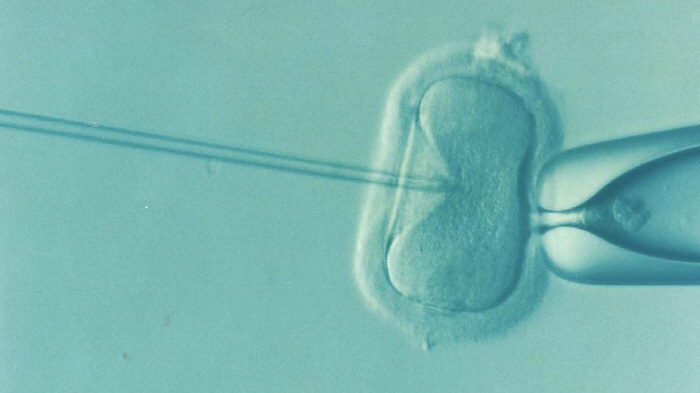 In vitro babies are more likely to give birth to boys. Why?