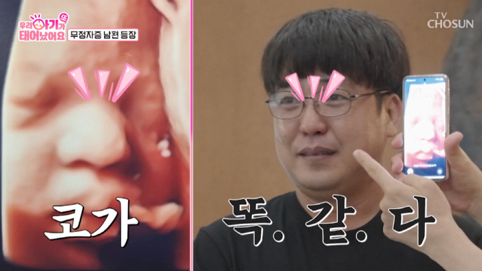 Anamnesiac husband, wife in her 40s, is pregnant for the first time in 18 years and married for the first time in 21 years (baby)