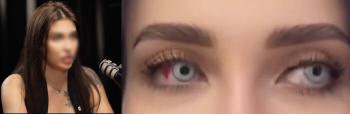 Changing the color of your eyes during pregnancy. Children also have blue eyes. This is why netizens need education