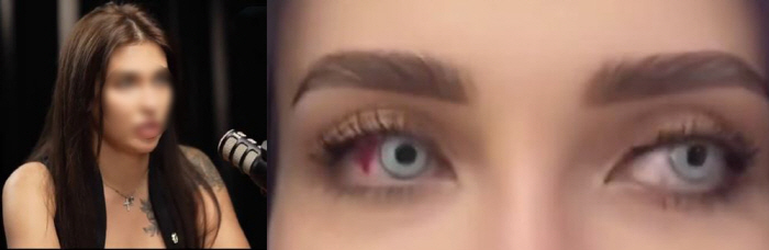 Changing the color of your eyes during pregnancy. Children also have blue eyes. This is why netizens need education