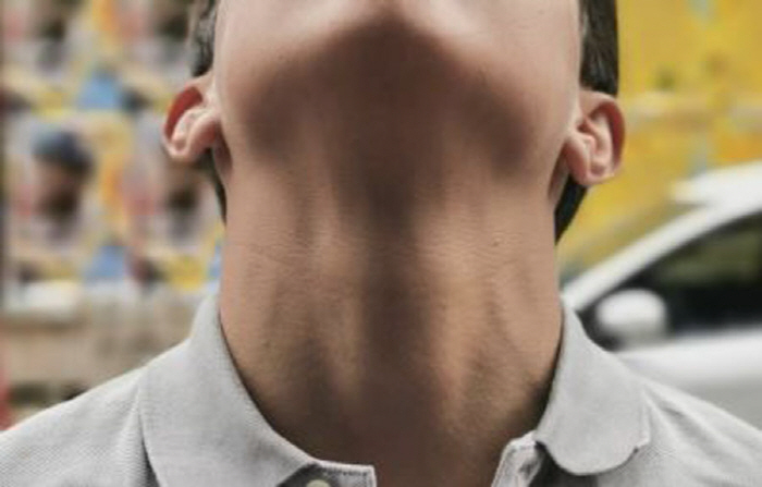 Honey, where's the tape measure?Men with a neck circumference of 43 cm or more, cardiovascular risk