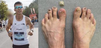 Jeong Hye-young ♥ Sean's shocking foot condition. He's missing his claws again, and he's holding four