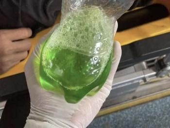 I thought toilet cleaner was a drink... The man who drank in a gulp dies, how?