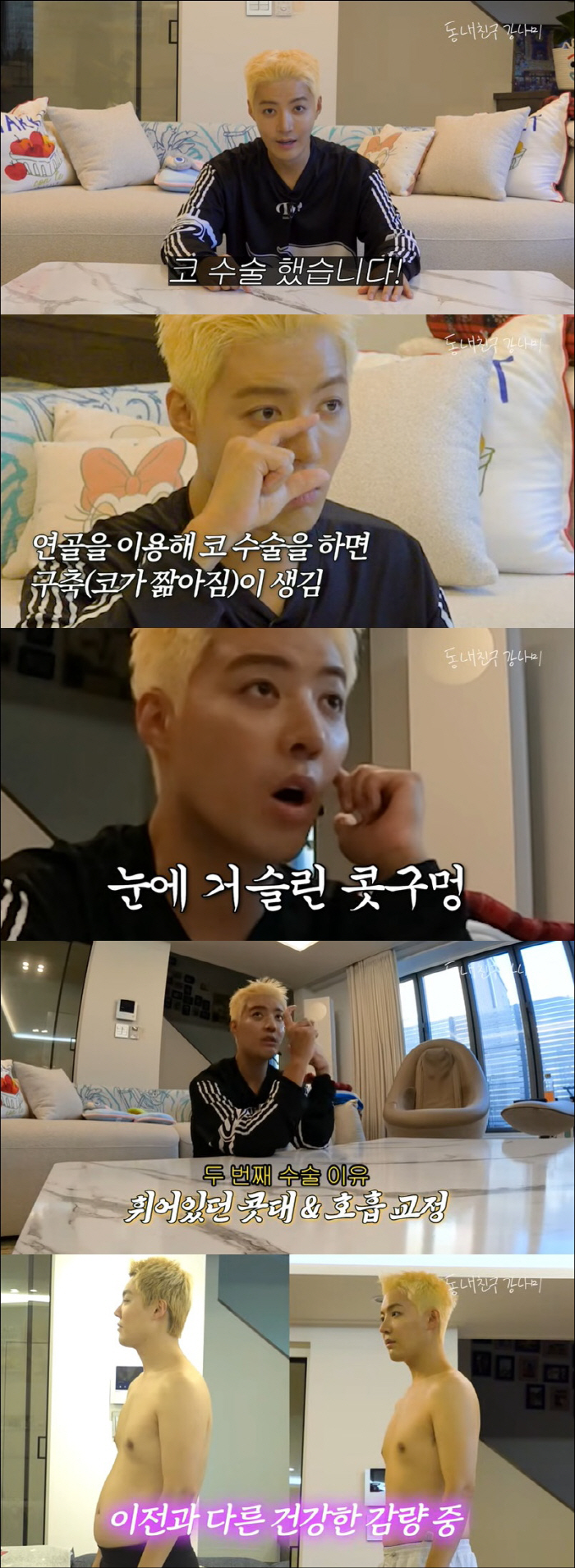 Lee Sang-hwa ♥ Gangnam has successfully lost 13kg for nose reoperation and can only see nostrils