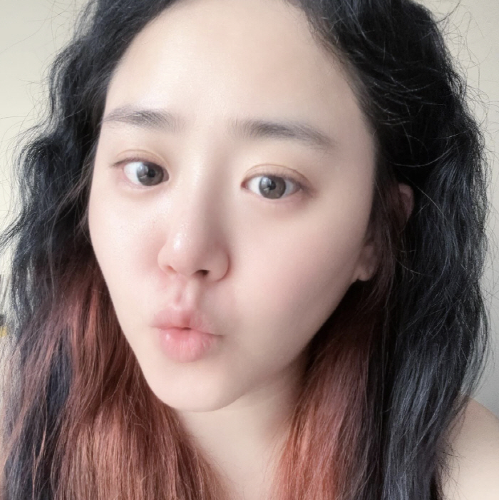 Moon Geun-young, 37, cured of rare disease, said he was on a diet..It's changed in seven months