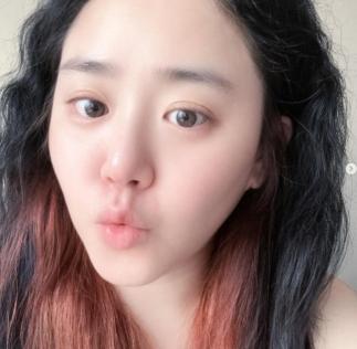 Moon Geun-young, who was cured of acute compartment syndrome, and Lovely with curly hair...She's still attractive