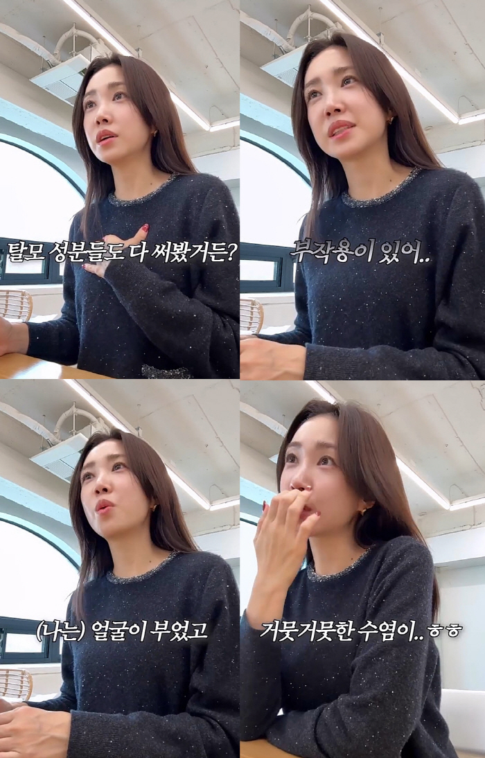 39-year-old Choi Hee diagnosed with female hair lossMy hair is falling out