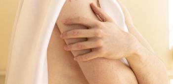 A man in his 40s diagnosed with stage 4 breast cancer...It's not just a woman's disease
