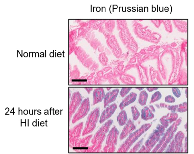 Identify the principle of normal tissue protection in the latest radiation therapy FLASH