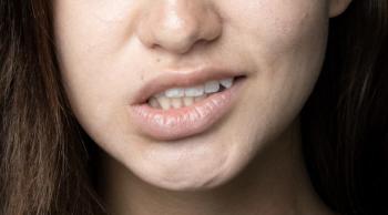 October 29th is World Stroke Day...Neighbors, hands, feet, and eyes can tell