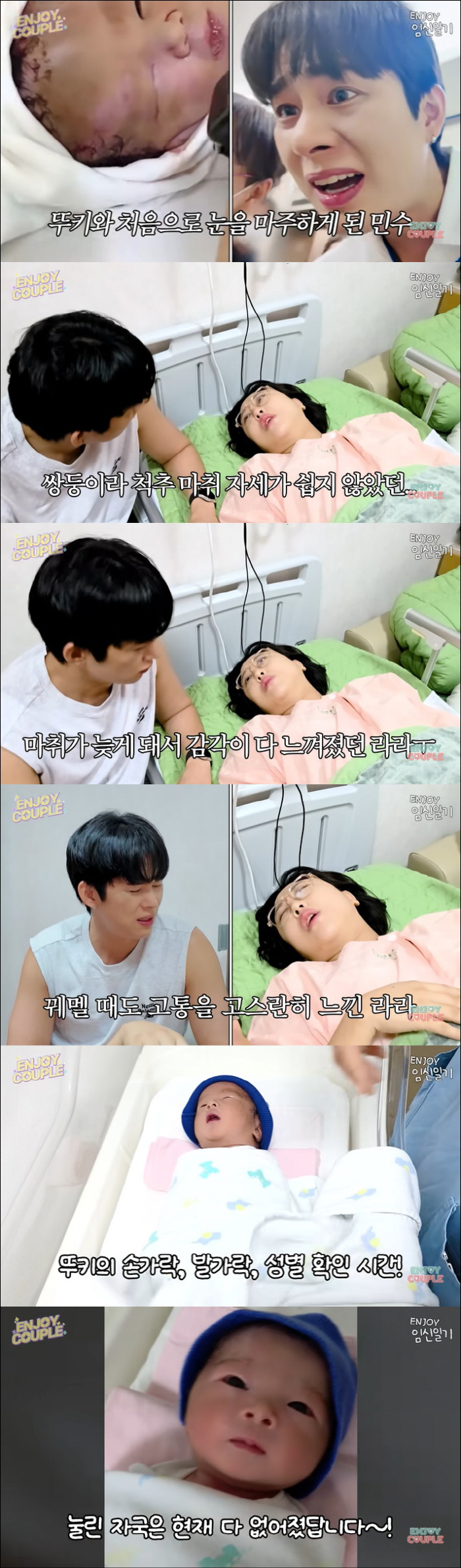 Postpartum bleeding Imra, the twin who risked their lives for public anesthesia, and I feel all the pain