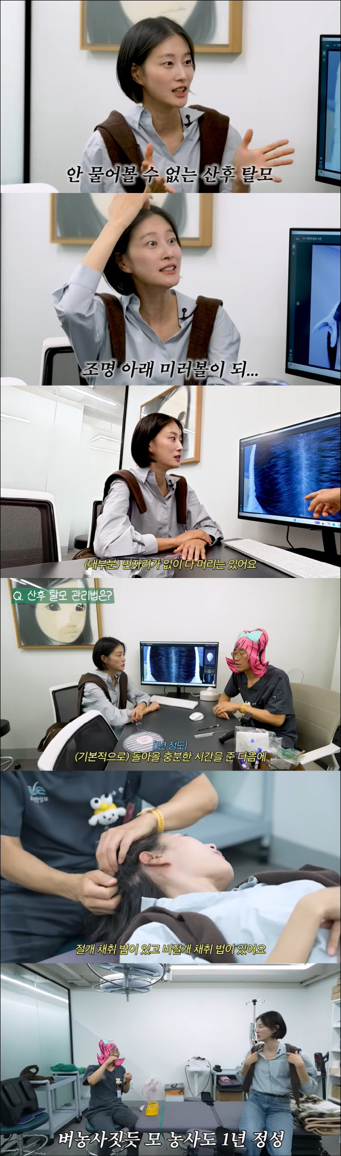 Lee Hyun-yi ended up lying on the operating table due to postpartum hair loss In my next life, I'll be a black person (working mom Lee Hyun)