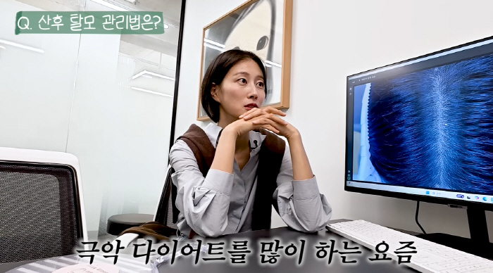 Han Sang-bo made a tremendous amount of money from hair loss proceduresLee Hyun confesses to postpartum hair loss