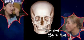 So-young Park, what is that on your skull after plastic surgery..'Put silicon in'