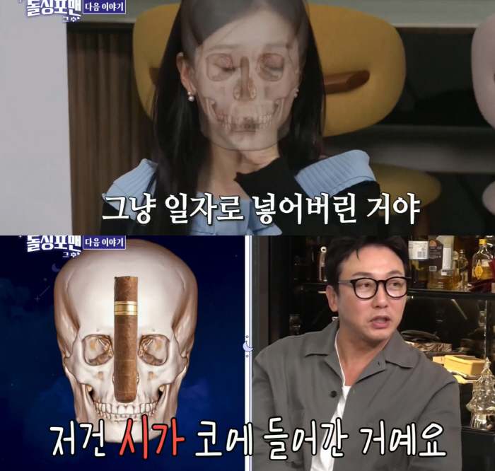 So-young Park, what is that on your skull after plastic surgery..'Put silicon in'