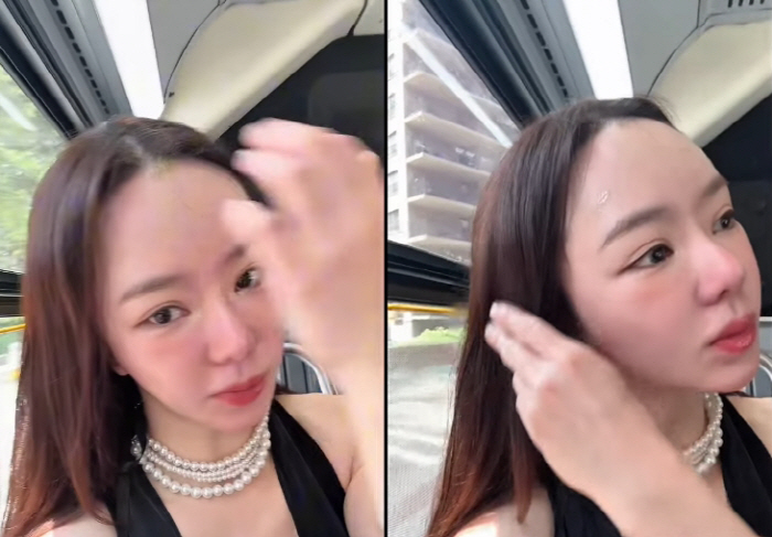  Seo-woo is surprised by how his face is swollen...What happened in New York