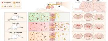 Diabetes drugs confirm the possibility of suppressing and preventing Parkinson's disease progression
