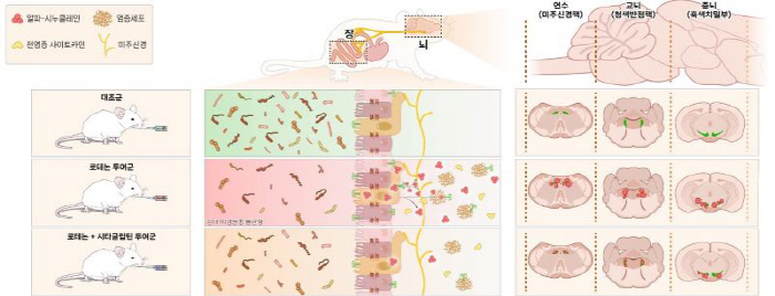 Diabetes drugs confirm the possibility of suppressing and preventing Parkinson's disease progression
