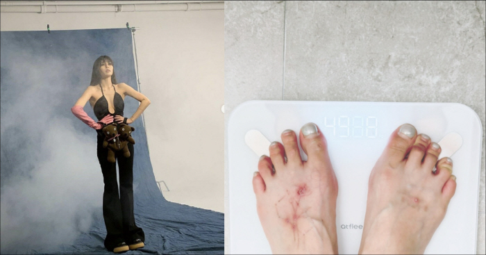 Hyun-ah erased the tattoo and succeeded in losing 10kg...We still have a long way to go before we get into the 40kg range