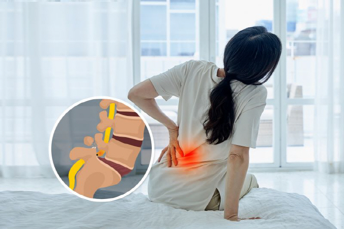 I thought it was back pain during the change of seasons...Spondylosis warning sign?