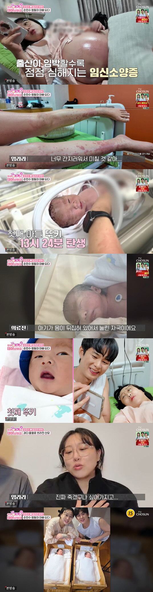 Im Lara fainted in ICU 10 times after giving birth to twins, and thought she was going to die