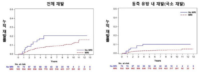 Breast cancer patients under 50 years old, preoperative MRI reduces recurrence in the ipsilateral breast