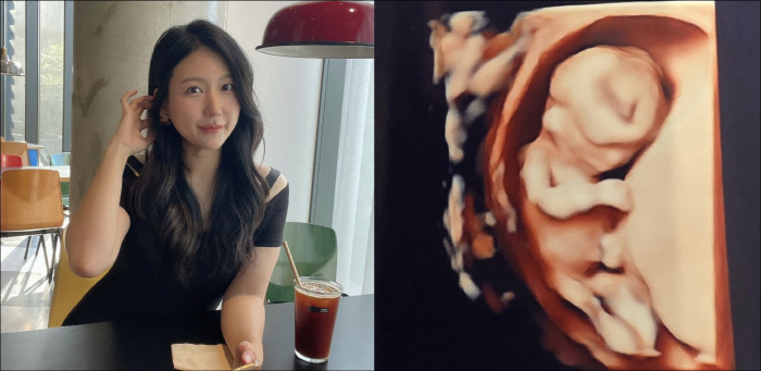 28th premarital pregnancy Jungsuk and Na Sol coolly reveal their gender. Pretty son who looks like his dad