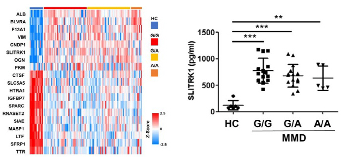 Discovery of Prediction Indicators for Diagnosing and Prediction of Childhood Moyamoya Disease...Expectations to present new treatments