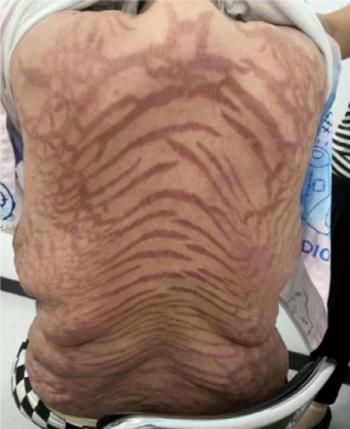 Snake skin shock to the entire body of a woman with skin ointment for 10 years...The seller is the devil