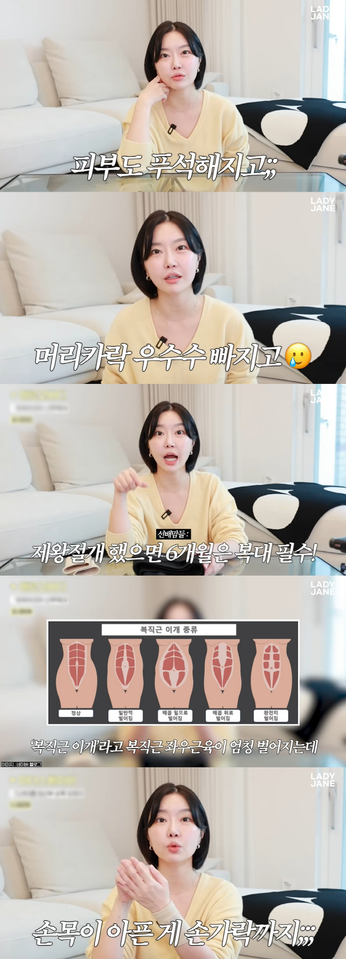 Twin Birth Lady Jane suffers from the aftereffects of cesarean section, and abdominal distension is essential