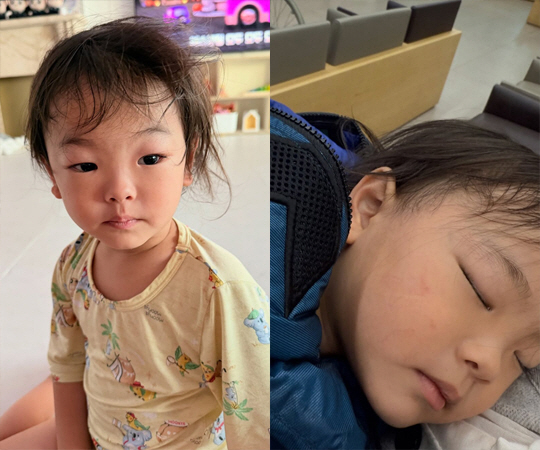 Jung Sung-ho ♥ Horse racing brightness, fifth son's eyes are swollen in the emergency room, blood tests and CT