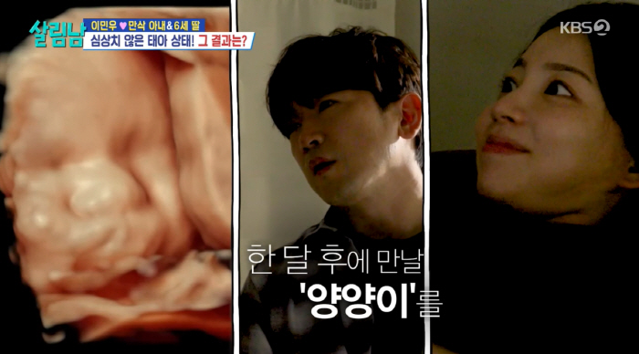 Lee Min-woo ♥ The wife-to-be with full-term birth is nervous about finding abnormalities with umbilical cord wrapped around the child's neck