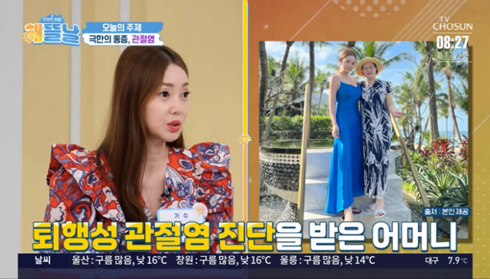 46-year-old Park Gyu-ri suffered a cerebral hemorrhage in her 30s, but she warned of degenerative arthritis again