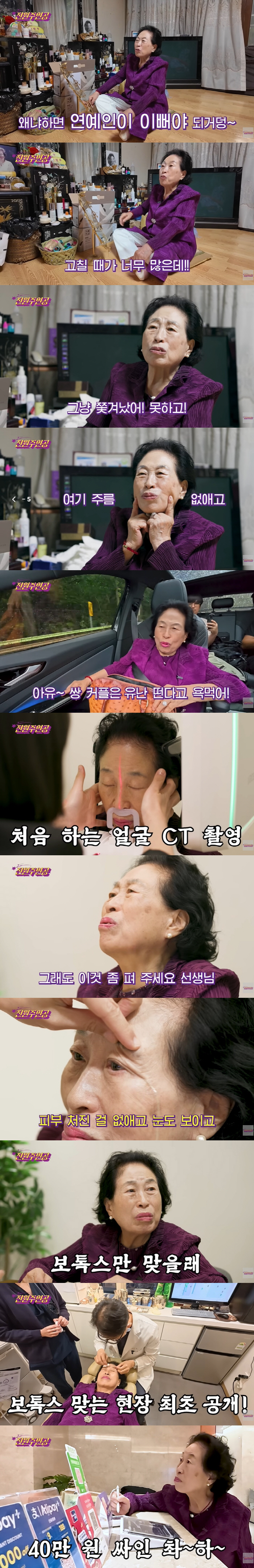 86-year-old Jeon Won-joo wants to become 50 million won younger than her plastic surgery estimate (Jeon Won main character)