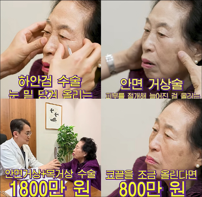 Jeon Won-joo, who has a health problem, decided to have facial colossus at the age of 86...30 million won ↑ Shocked by the estimate