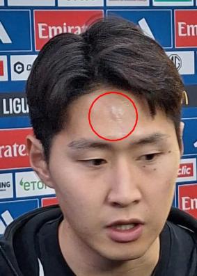 Lee Kang-in, who was doing well, is a shocking injury! The cause of the opponent's rough foul → caught swollen marks...It's a big deal if you get hurt at an important time