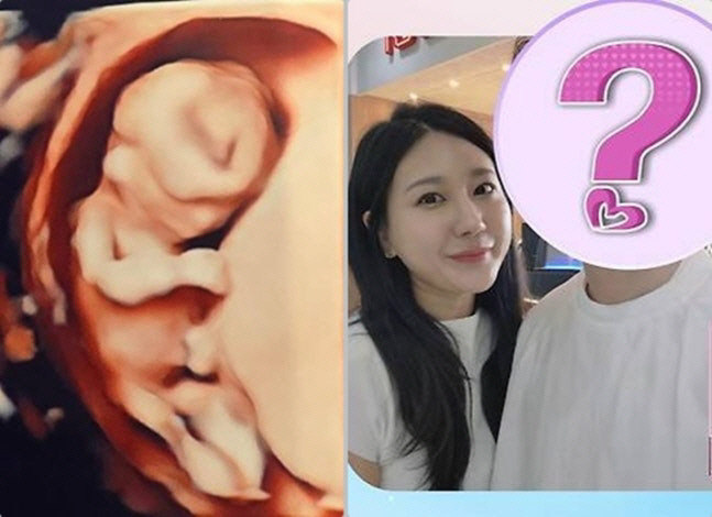 Jeongsuk, the 28th pregnant woman before marriage, revealed her ♥ husband's identity..MCs, really? Shocking (I'm single)
