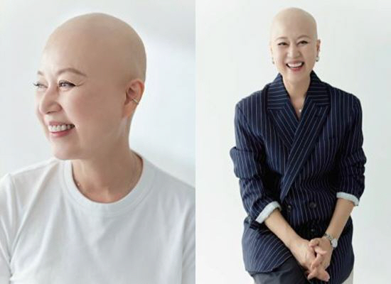 Park Mi-sun, you look like Furiosa with a shaved head of chemotherapy?→ Laugh at Jo Se-ho's apology and hope rather than despair