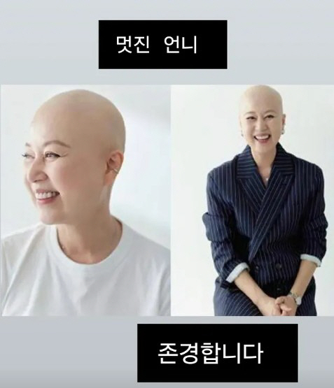 Cho Hye-ryeon, Park Mi-sun Applause for the courage of her bald head to fight cancer...I respect.