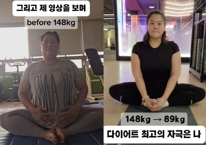 Mina's sister-in-law reveals 148kg → 89kg before and after the best plastic surgery