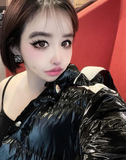 Park Bom’s Latest Photo Sparks Concern Among Fans