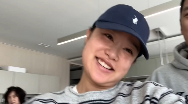 Heiseni, due to swelling of the face lifting procedure after giving birth to the second child