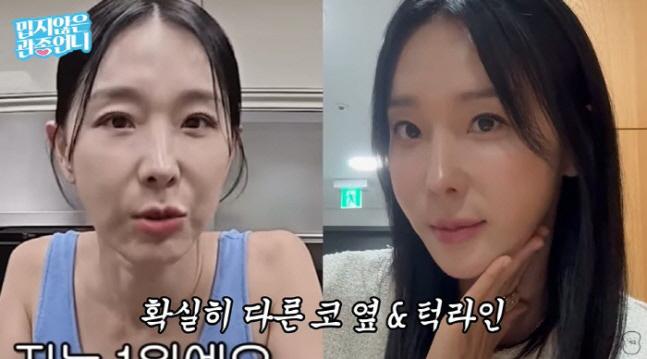 Lee Ji-hye, make someone else look different after the thread lifting procedure