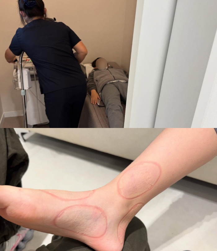 Single mom Kang Sung-yeon cracked an angry ligament in an accident at school, causing unilateral damage