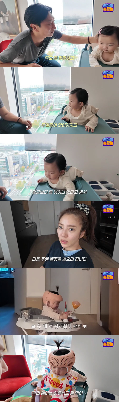 Lee Kyu-hyuk ♥ Son Dam-bi, 7-month-old daughter begins head correction...I'm sleepy because of Halmet