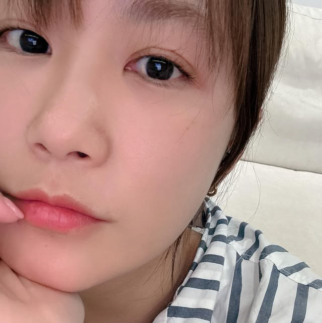 Kim Ji-min, 41, can't hide under-eye spots..Care with regenerative cream